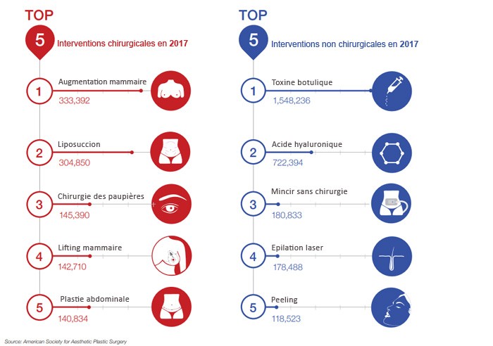 Le top 5 des interventions chirurgicales et non chirurgicales en 2017 aux Etats-Unis