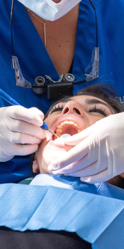 Technique d'éclaircissement sur dents dépulpées