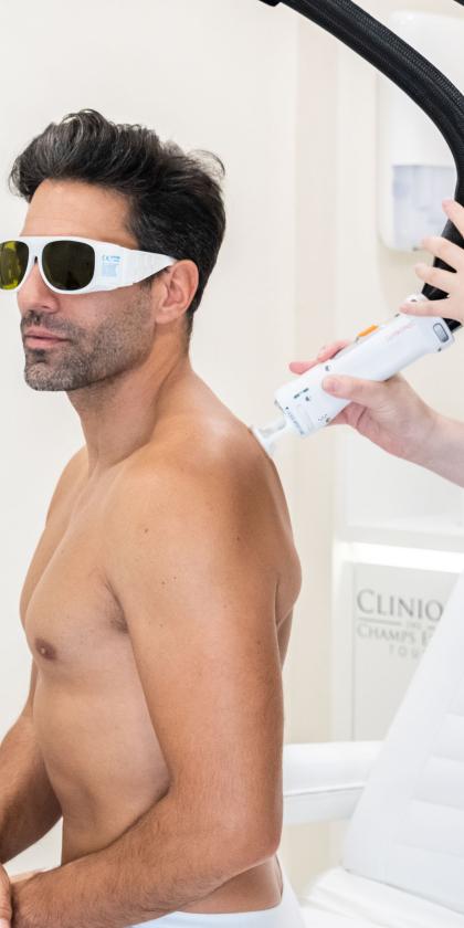 Epilation définitive : choisir entre laser ou lumière pulsée (IPL