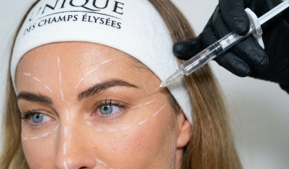 couv-injections-acide-hyaluronique-clinique-des-champs-elysees
