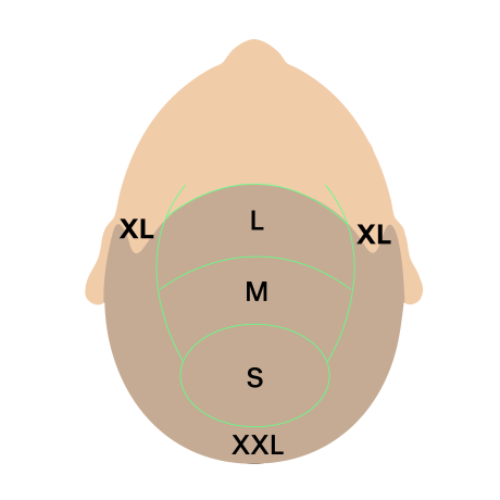 Tricopigmentation : Zones