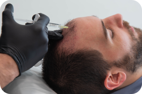 solutions-capillaires-mesotherapie