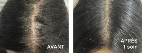 Réduire l'élargissement de la raie des cheveux