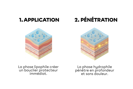 Comment se déroule une séance de BioRePeelCl3 ?