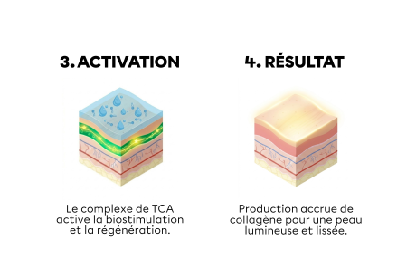 Comment se déroule une séance de BioRePeelCl3 ?