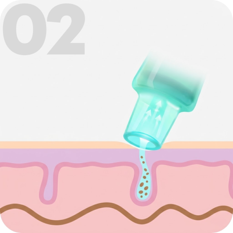 hydrafacial-etape-2-extraction-hydratation