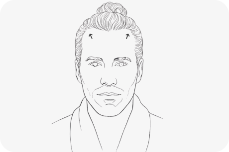 illustration-alopecie-de-traction