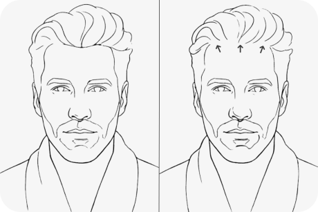 illustration-mature-hairline