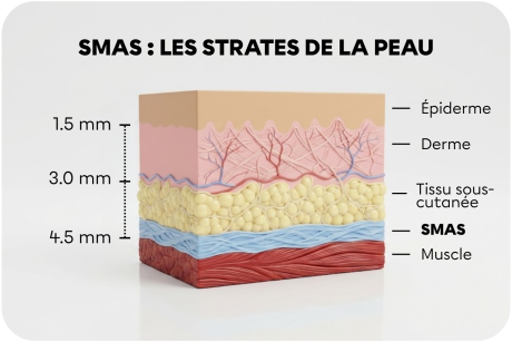 schema_smas_clinique_des_champs_elysees