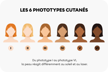 illustration-phototypes