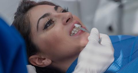 Blanchiment des dents avec gouttière (dents jaunes) à Paris | Technique et prix | Clinique des Champs-Elysées