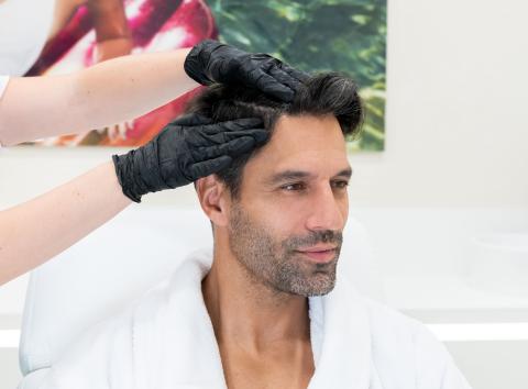 Calvitie précoce : Quand faire une greffe de cheveux ? | crpce