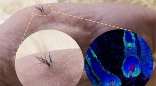 Régénération des follicules pileux avec les cellules souches