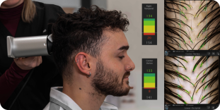 DIAGNOSTIC CHEVEUX-actu-hairmetrix