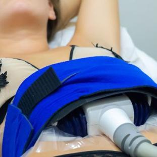 Coolsculpting