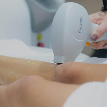 Epilation laser des jambes à Paris | Séances et prix | Clinique des Champs-Elysées