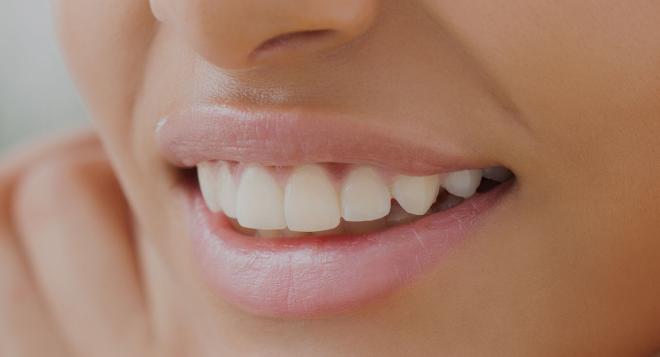 Alignement des dents : Comment corriger les défauts de dentition ? | Clinique des Champs-Elysées