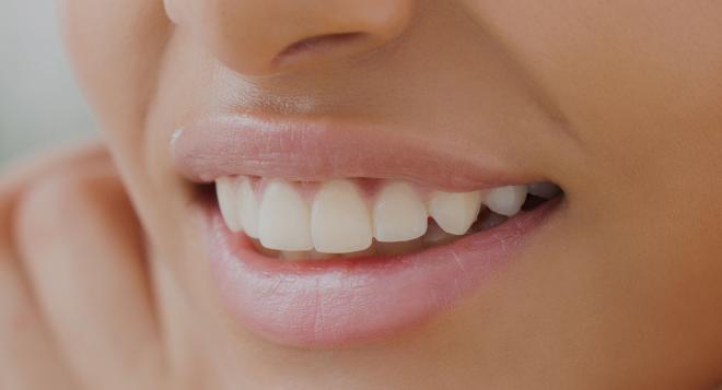 Alignement Des Dents Comment Corriger Les Defauts De Dentition Clinique Des Champs Elysees Alignement Des Dents Comment Corriger Les Defauts De Dentition Clinique Des Champs Elysees