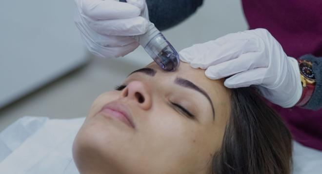 couv-dermafrac