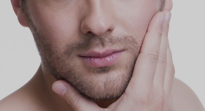 Epilation laser de la barbe à Paris | Séances et prix | Clinique des Champs-Elysées
