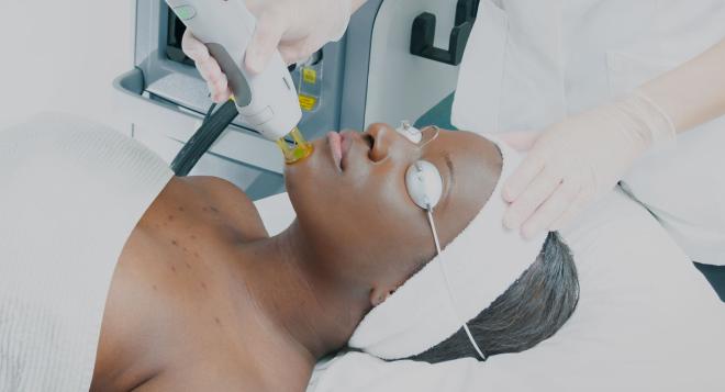 Epilation laser des peaux mates et foncée à Paris | Clinique des Champs-Elysées