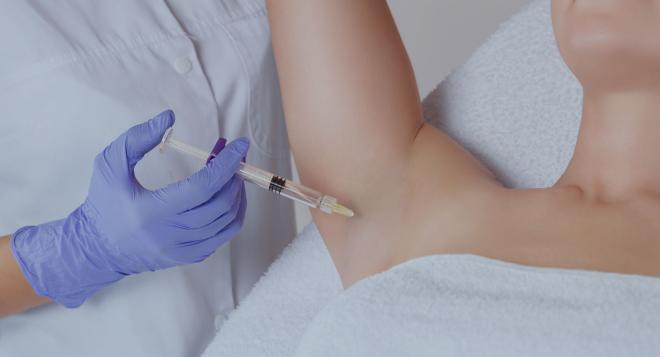 Injection de Botox à Paris contre l'hyperhidrose | Séance et tarifs | Clinique des Champs-Elysées