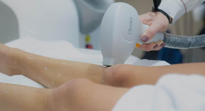 Epilation laser des jambes à Paris | Séances et prix | Clinique des Champs-Elysées
